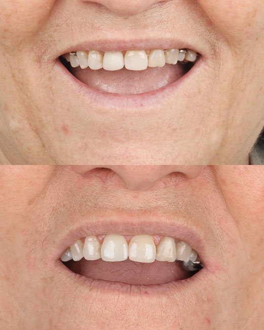 Casos-Antes-e-Depois1