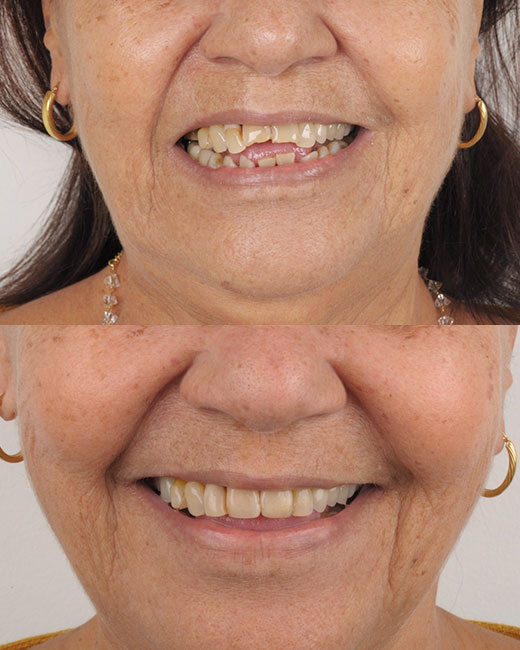 Casos-Antes-e-Depois2