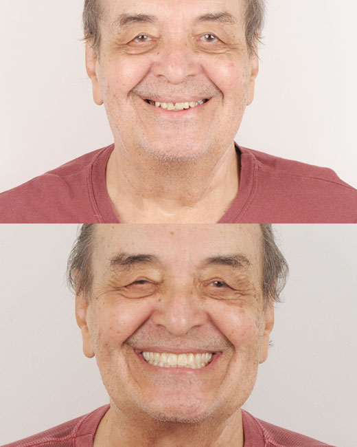 Casos-Antes-e-Depois3